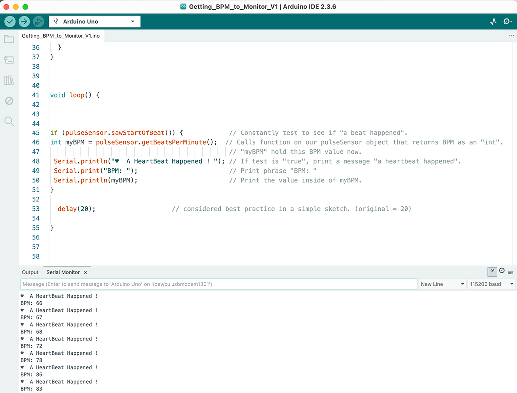 With the Serial Monitor showing typical/normal numbers for BPM, we figured out then that the issue was not the code, but rather the sensor itself